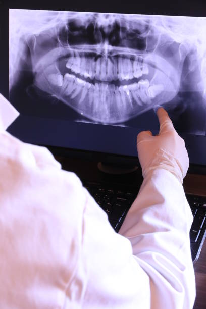 Best Emergency Dental Extractions in El Campo, TX
